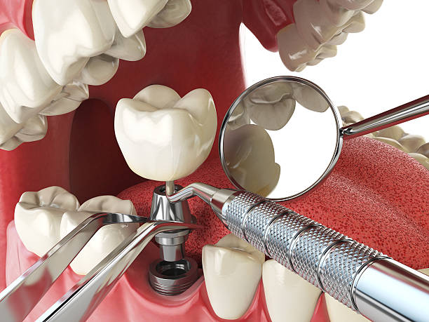 Best Dental Abscess Treatment in Mountain Top, PA